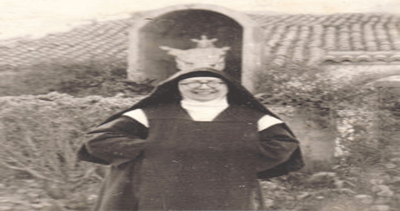 Procedure - Pedro della Madre di Dio